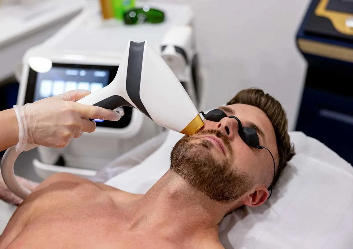 Laser Hair Removal for men face