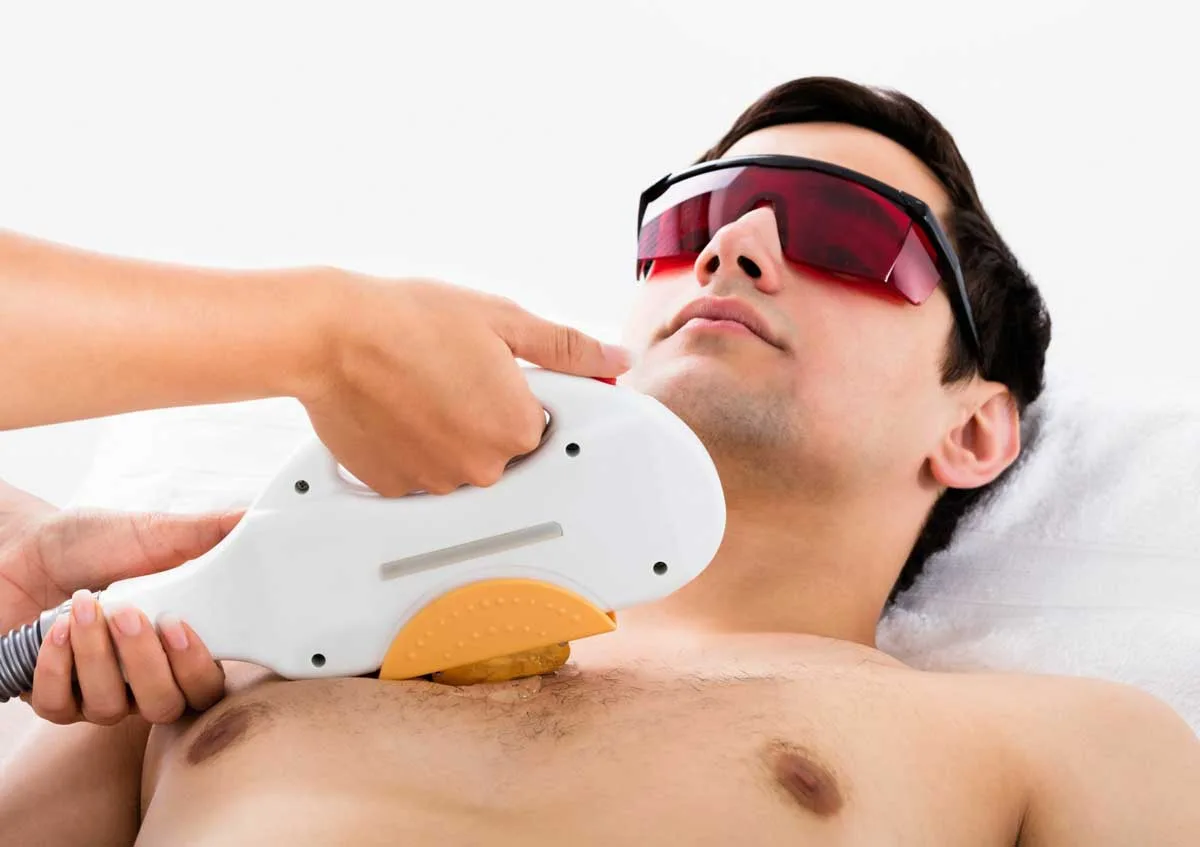 male chest Laser Hair Removal in Toronto
