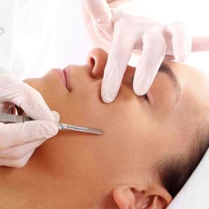 dermaplaning-treatment