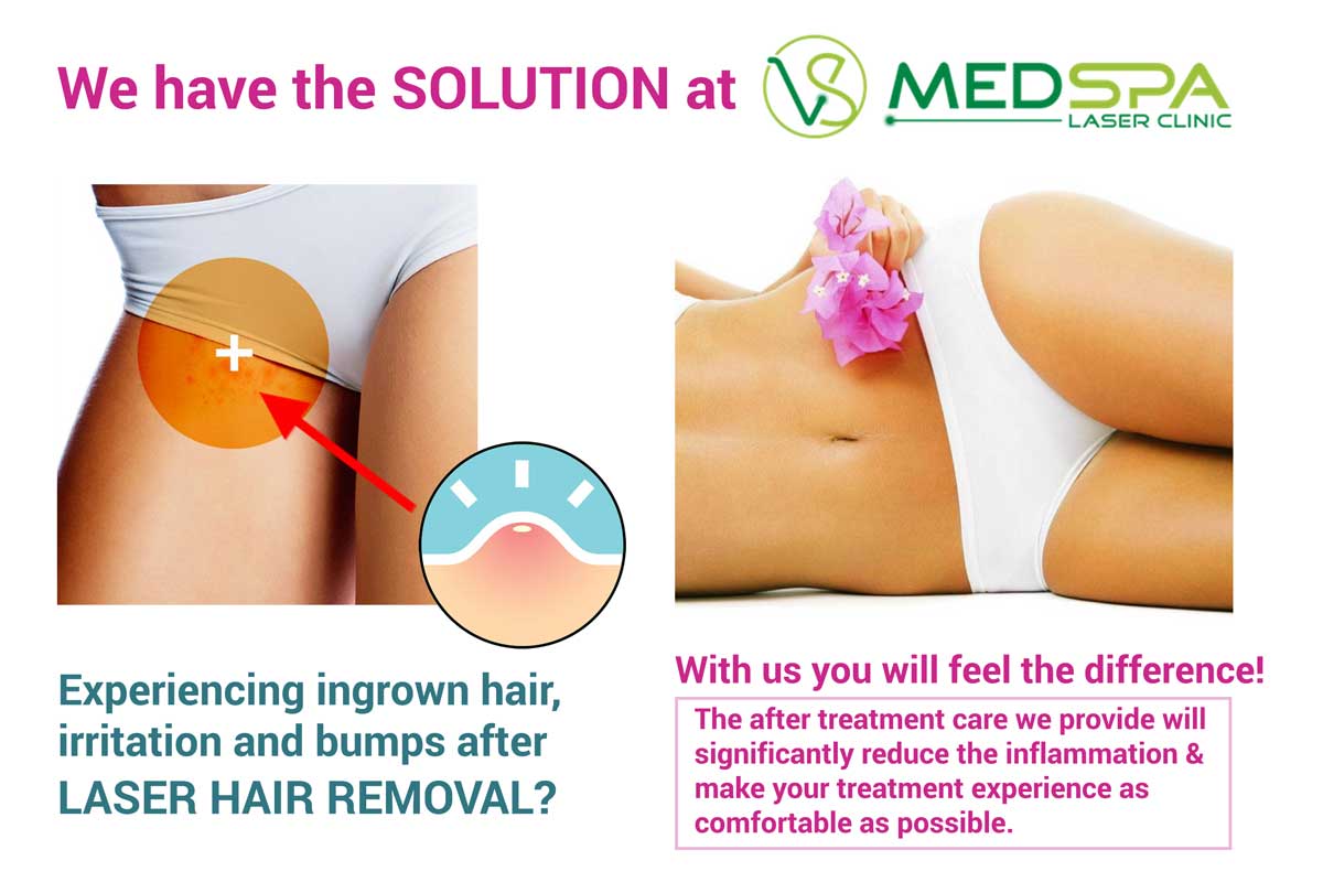 infgown-hair after treatment care