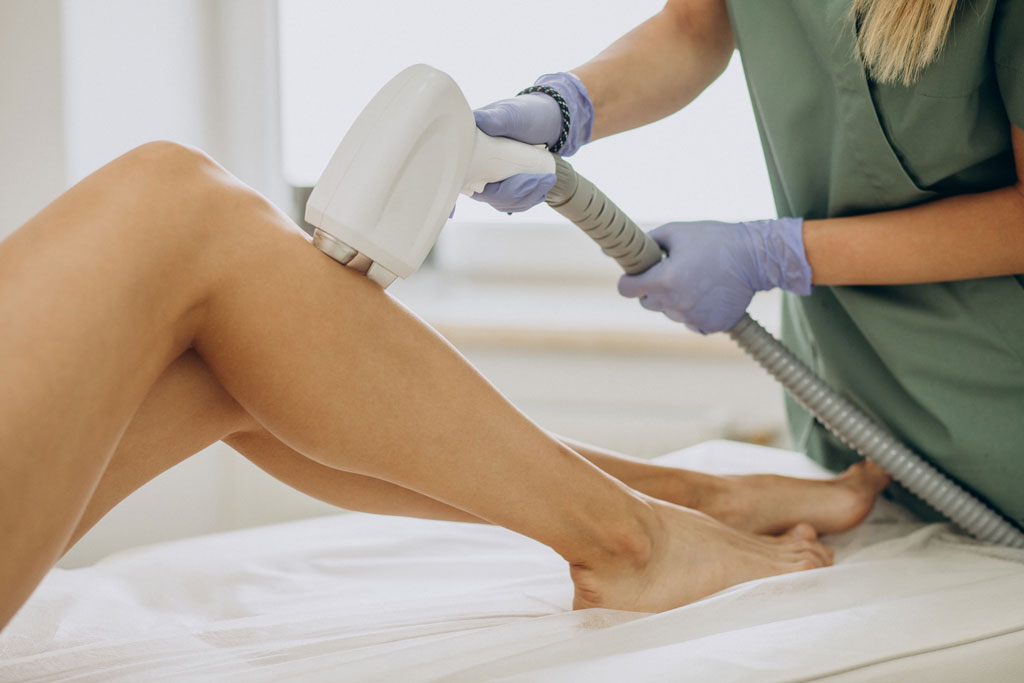 laser-epilation-hair-removal-therapy laser hair removal for women in Toronto full legs