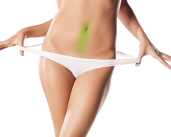 laser-hair-removal-belly-button-women-600x480 laser hair removal belly button women