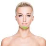 Chin Laser Hair Removal