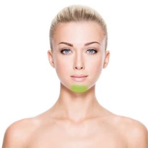 Chin Laser Hair Removal