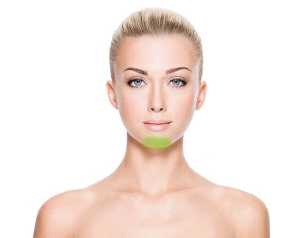 laser-hair-removal-chin-women Chin Laser Hair Removal