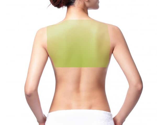 laser-hair-removal-upperback-women-600x480 Laser Hair Removal for Women, Upper back