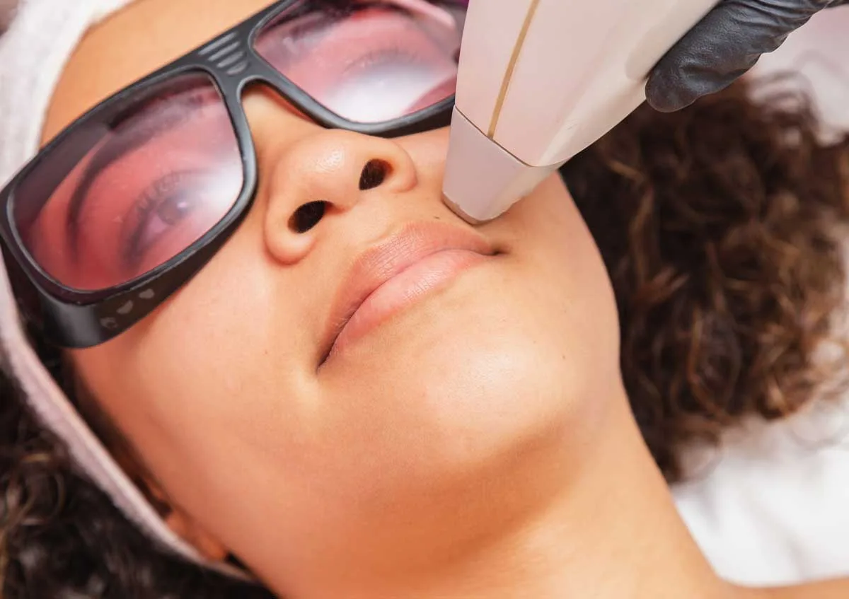 female laser hair removal face