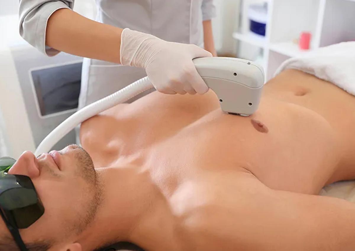 male-full-body-laser-hair-removal male full body laser hair removal