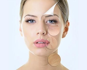 skin-care-fractional-laser fractional laser