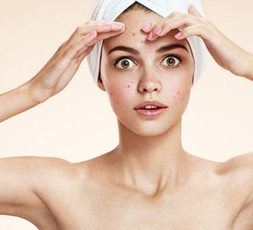 acne treatment and acne scar removal