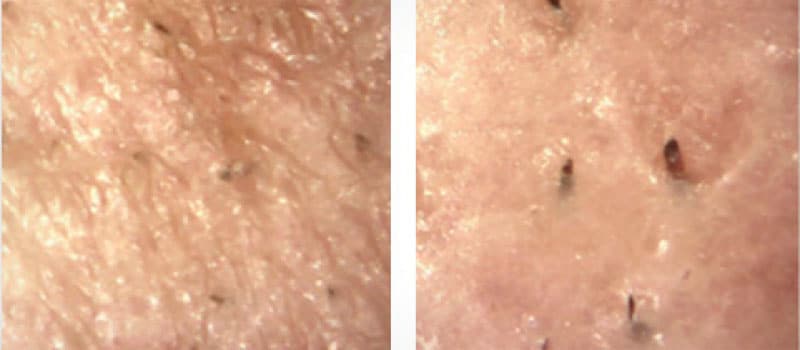 oxygeneo before and after texture