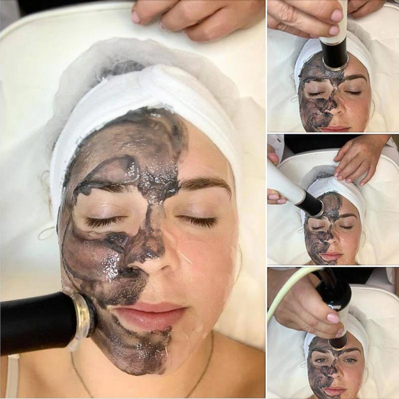 OxyGeneo Balance Charcoal Facial