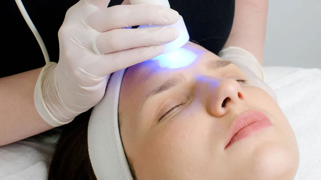 Cold Laser Facial treatment