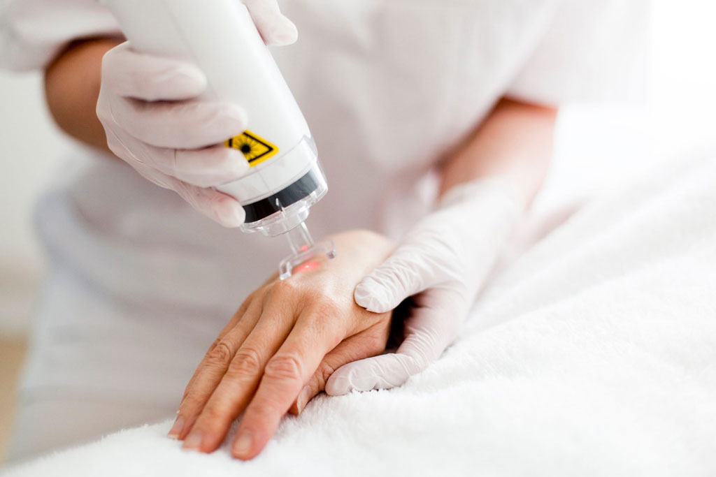PIXEL-fractional-laser-skin-resurfacing-hands PIXEL fractional laser skin resurfacing hands