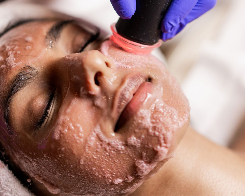 Revive-OxyPod-treatment Revive OxyPod treatment