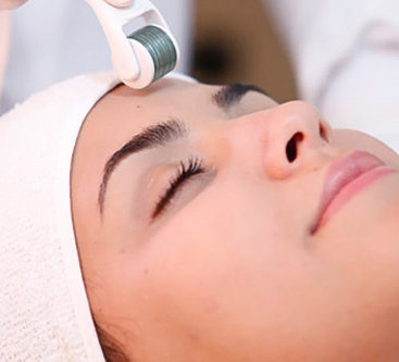dermaroller facial