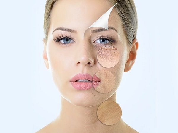 laser facial fractional laser pixel