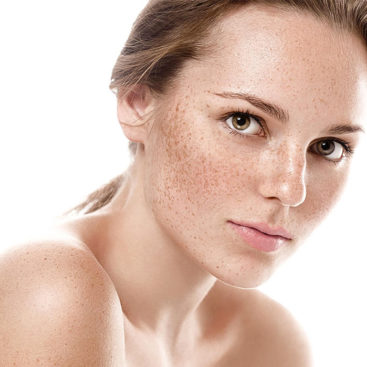 PIGMENTATION AND MELASMA