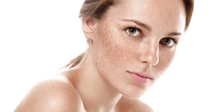 PIGMENTATION AND MELASMA
