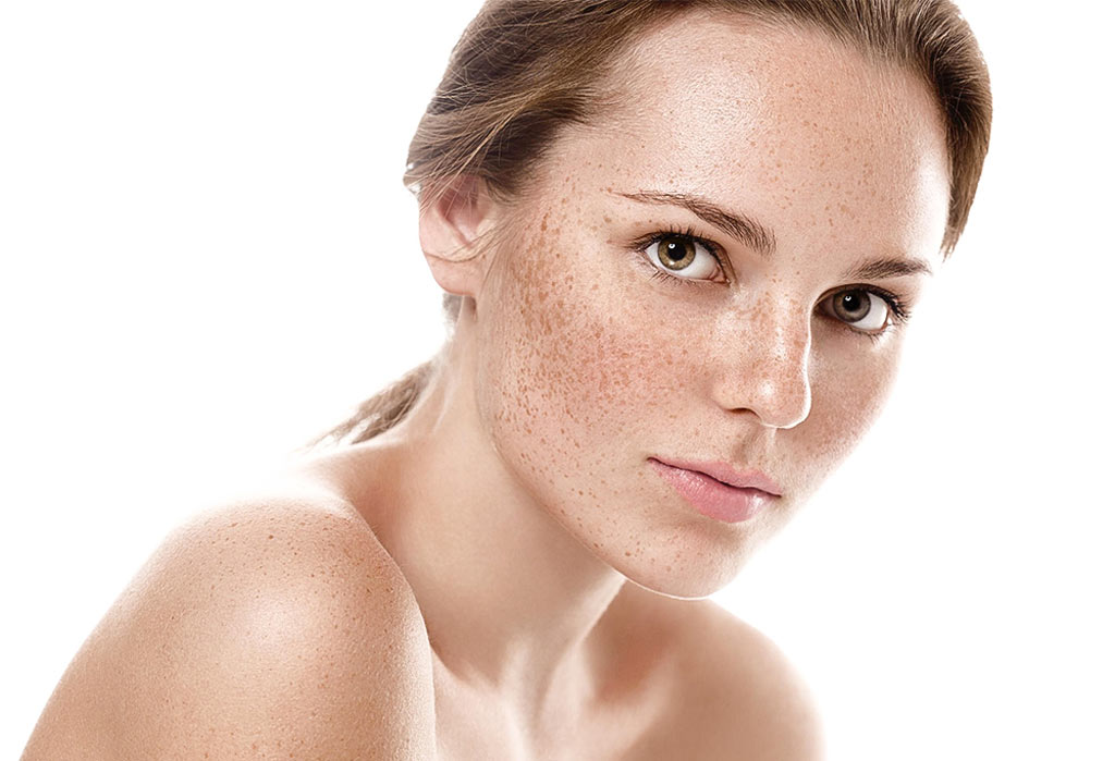 PIGMENTATION-AND-MELASMA PIGMENTATION AND MELASMA