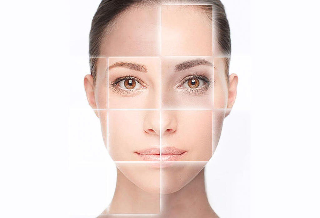 SUN-DAMAGE SUN DAMAGE, melasma