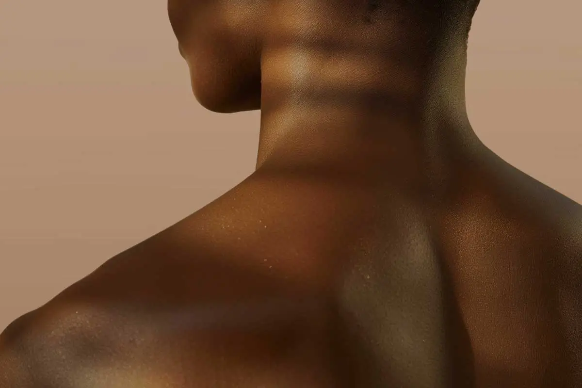 Back of Neck Laser Hair Removal