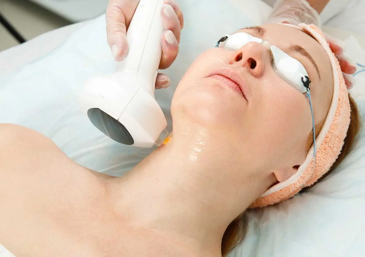 IPL-Decollete-neck-Rejuvenation IPL Décolleté Rejuvenation