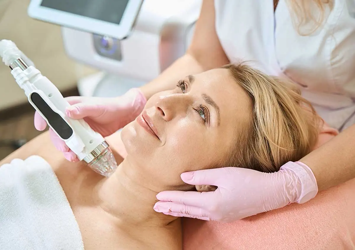 Microneedling-for-Decollete-and-neck Microneedling for Décolleté, chest and Neck