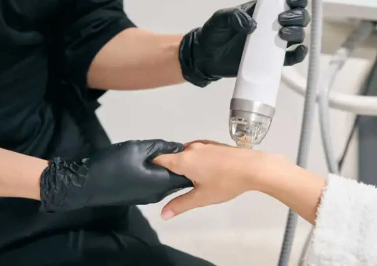 Microneedling-for-hands-and-arms Microneedling for hands in Toronto