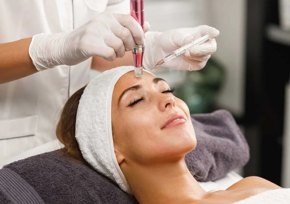 Microneedling-with-Hyaluronic-Acid Microneedling with Hyaluronic Acid