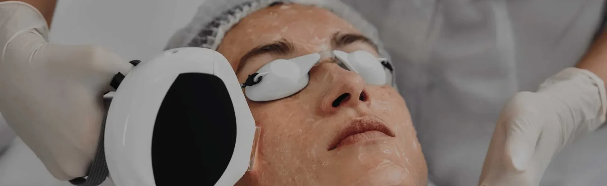 professional IPL Photofacial treatment VS MedSpa