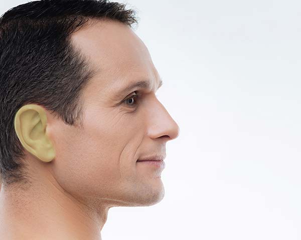Ears-laser-hair-removal-for-men Ears laser hair removal for men