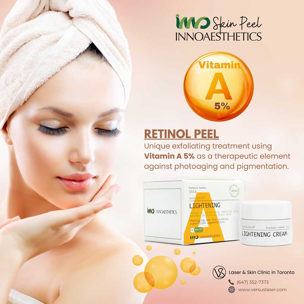 Innoaesthetics-Lightening-Retinol-Peel Innoaesthetics Retinol Lightening Yellow Peel