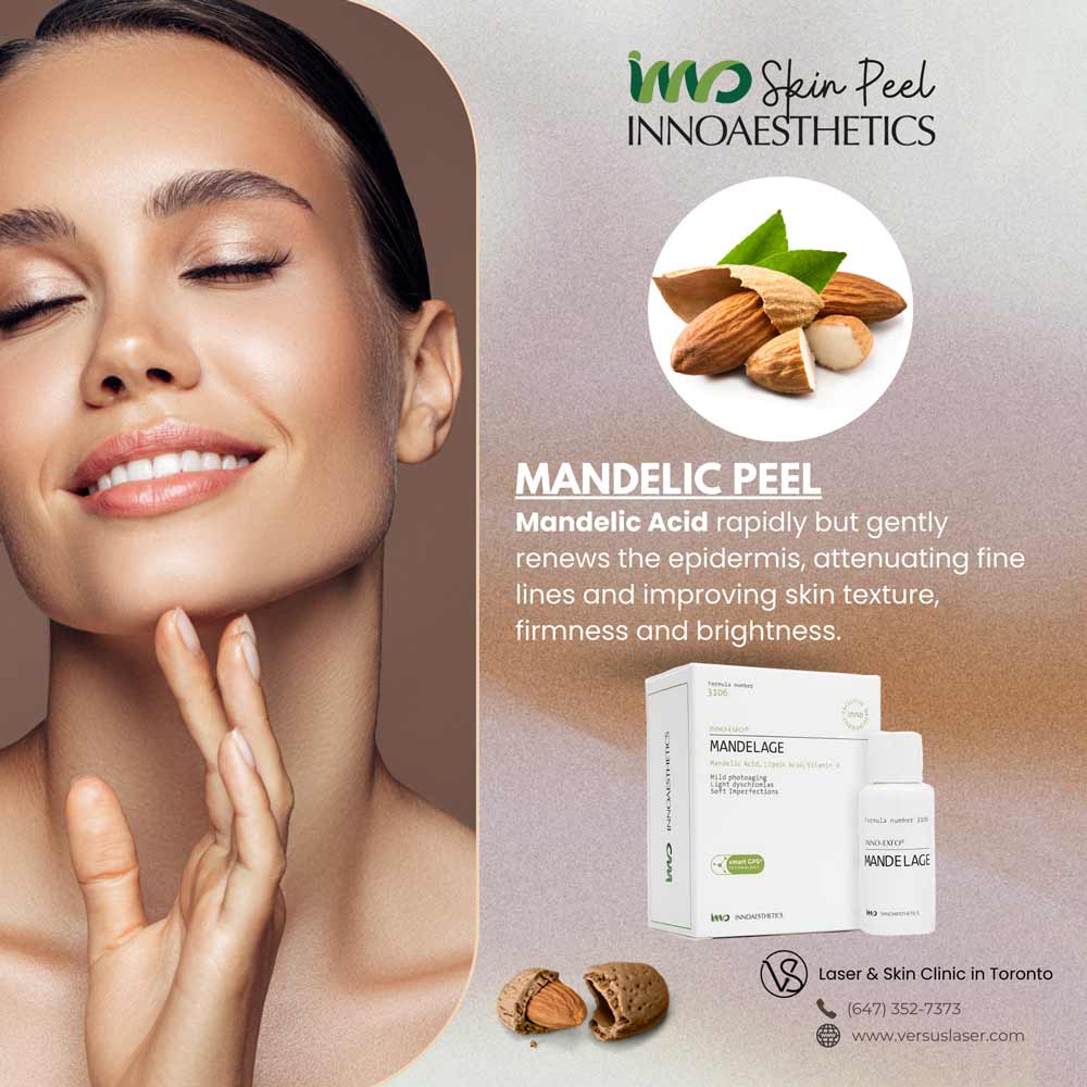Innoaesthetics-MANDELAGE-Mandelic-Acid-peel Innoaesthetics MANDELAGE Mandelic Acid peel