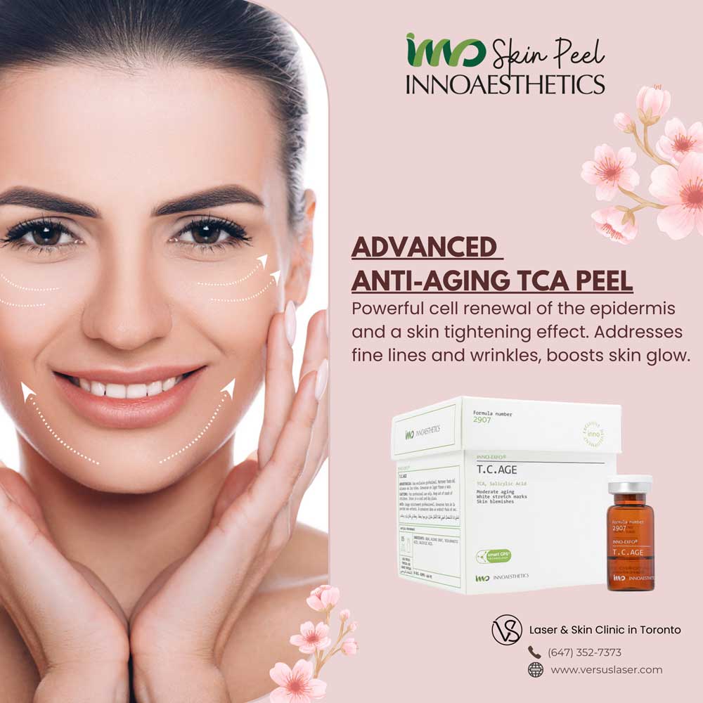 Innoaesthetics-anti-aging-TCA-peel Innoaesthetics anti aging TCA peel