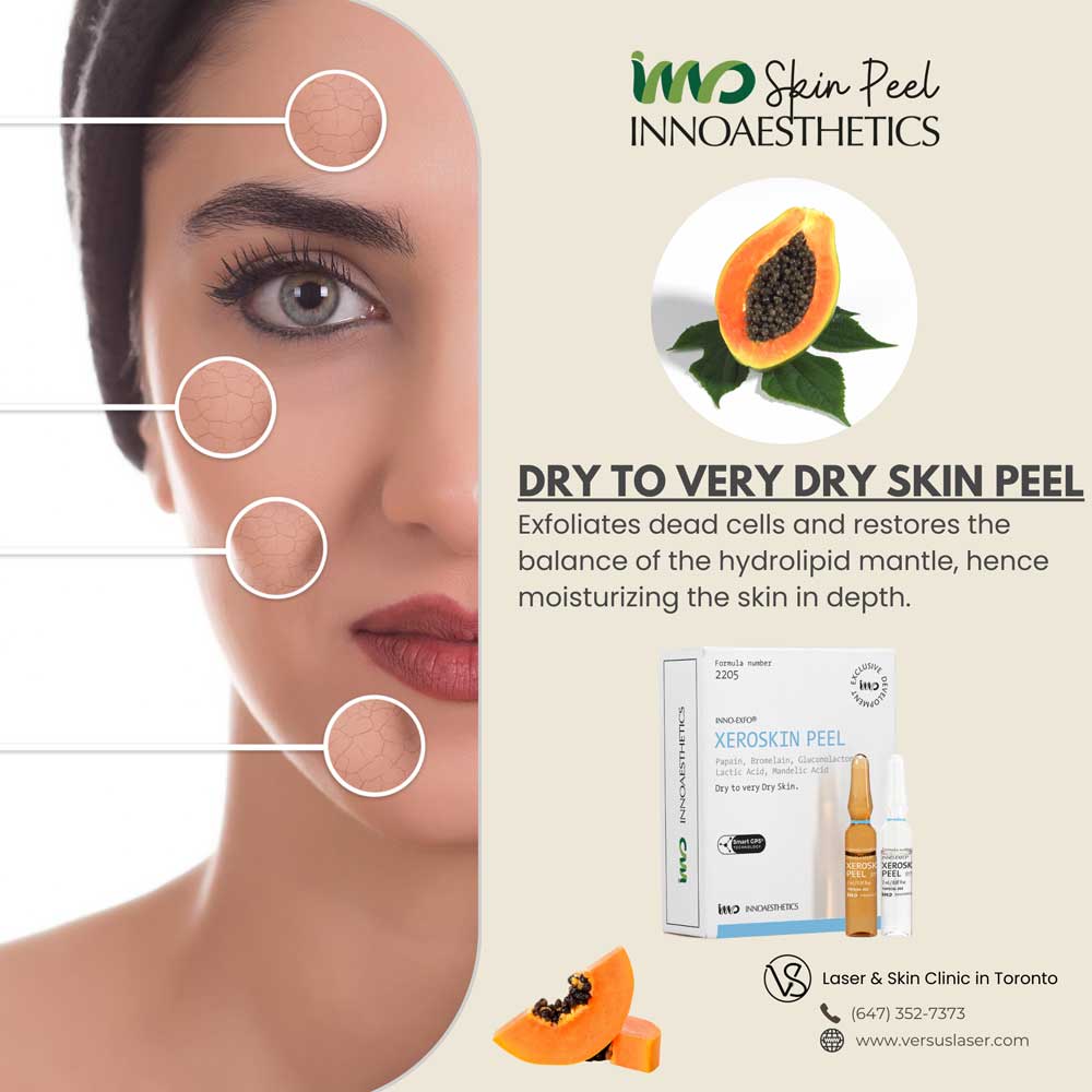 Innoaesthetics-dry-skin-XEROSKIN-peel Innoaesthetics dry skin XEROSKIN peel