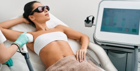 cost of laser hair removal in toronto