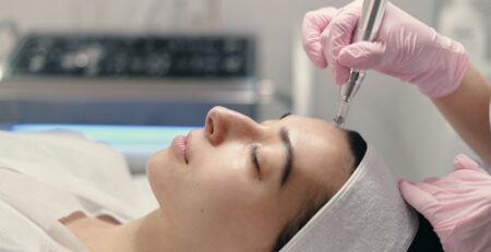 Chemical Peel vs Microneedling