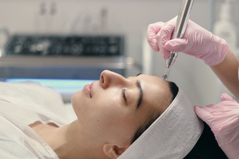 microneedling-facial Chemical Peel vs Microneedling