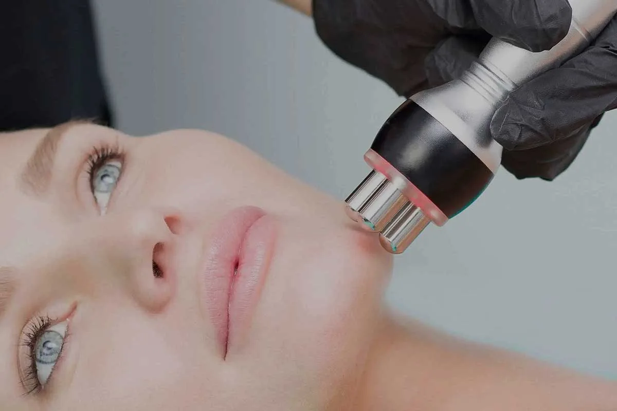 RF Skin tightening Facelift