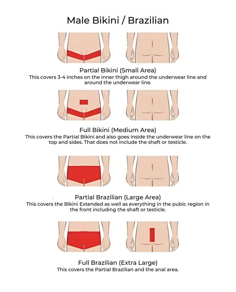 VS-MedSpa-Male-Bikini-vs-Brazilian-hair-removal male bikini laser hair removal