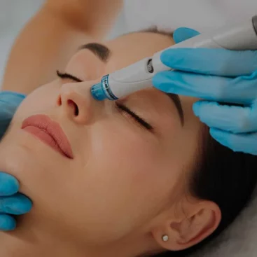 hydrafacial Toronto