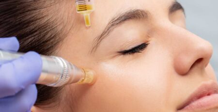 microneedling with exosomes facial rejuvenation